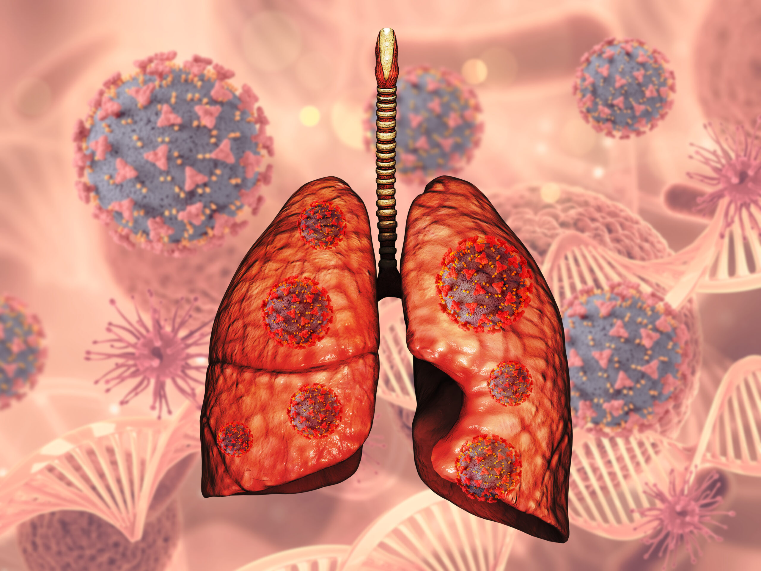 Lung Cancer Treatment treatment