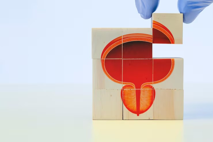 Bladder Cancer Treatment