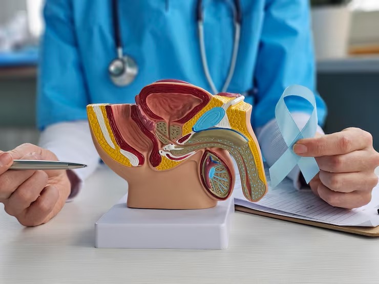 Prostate Cancer Treatment treatment