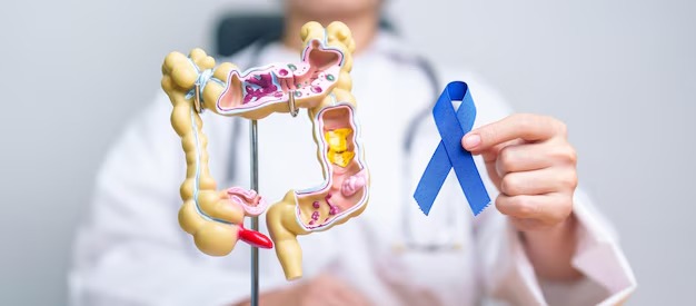 Colorectal Cancer Treatment