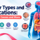 Cancer Types and Locations