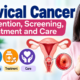 Cervical Cancer